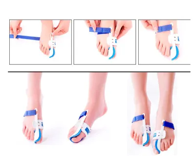 Toe Correction Night Foot Care Orthotics