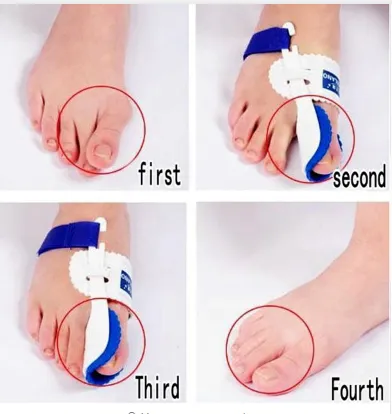 Toe Correction Night Foot Care Orthotics